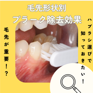 毛先が重要！ハブラシ選びで知っておきたい「形状別プラーク除去効果」