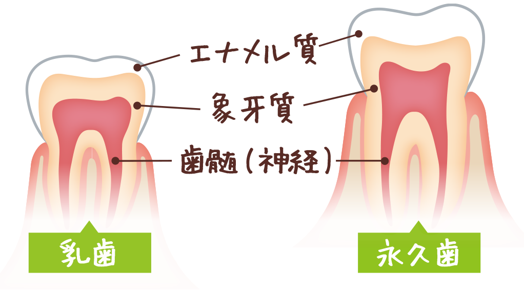 子どものう蝕は進行が早い！