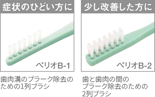 ボンディング処理によってベタつきがなく、切れにくい!