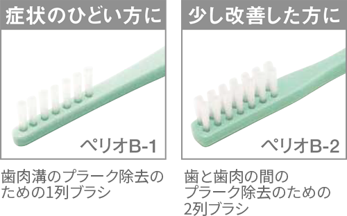 ボンディング処理によってベタつきがなく、切れにくい！