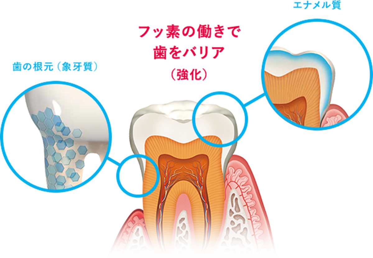 エナメル質 歯の根元(象牙質) フッ素の働きで歯をバリア(強化) (イメージ図)