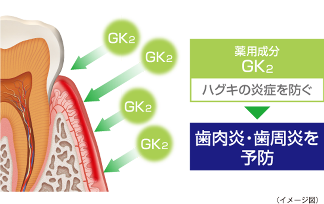 薬用成分GK2 ハグキの炎症を防ぐ 歯肉炎・歯周炎を予防 （イメージ図）