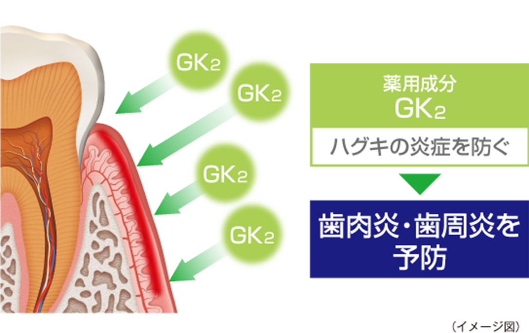 薬用成分GK2 ハグキの炎症を防ぐ 歯肉炎・歯周炎を予防 (イメージ図)
