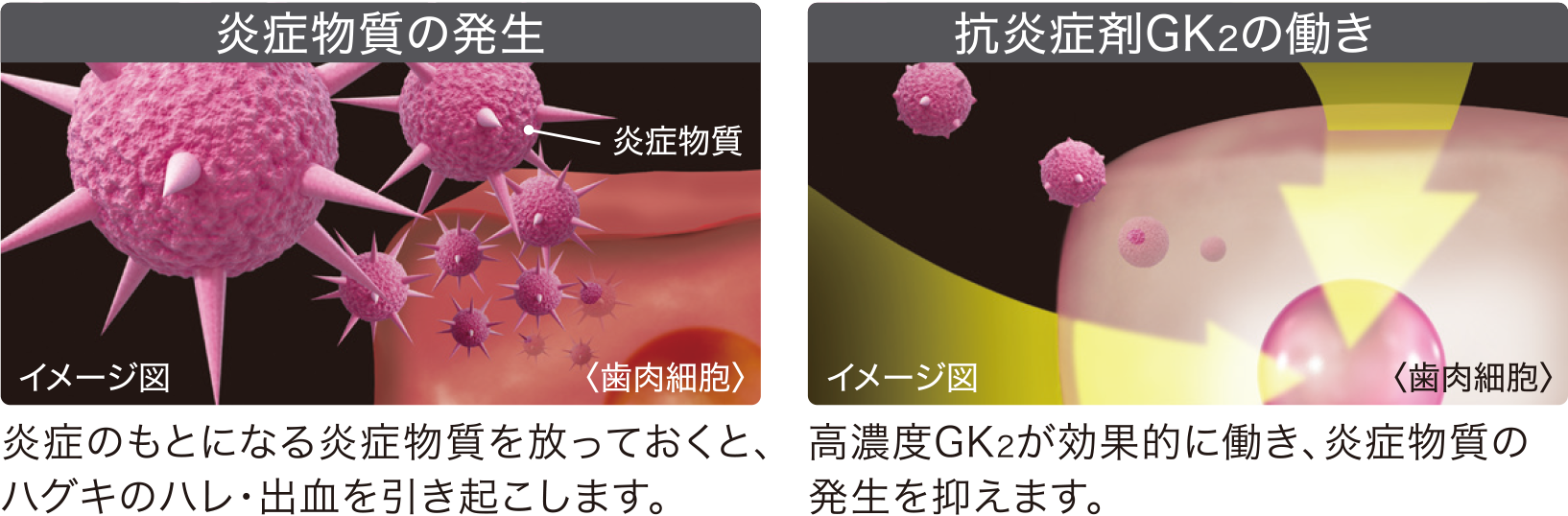 歯肉(ハグキ)のハレや炎症を抑制