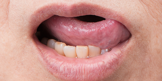 4.舌を使って頬粘膜、口唇の裏に塗り広げます。
