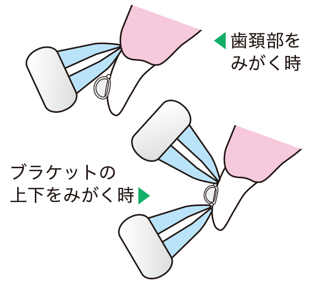 「歯頸部をみがく時」「ブラケットの上下をみがく時」