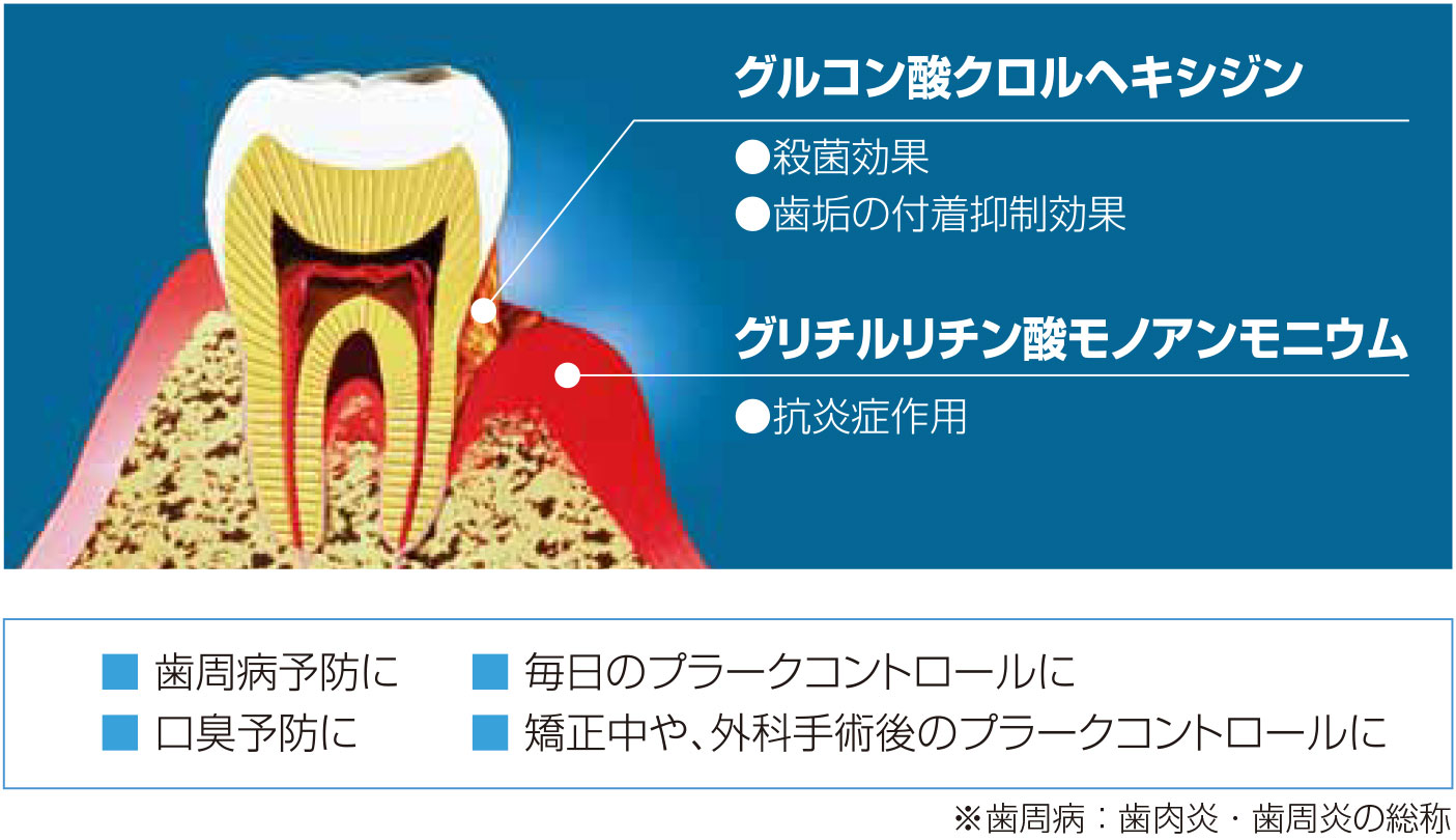 グルコン酸クロルヘキシジン ●殺菌効果 ●歯垢の付着抑制効果 グリチルリチン酸モノアンモニウム ●抗炎症作用 ■歯周病予防に ■毎日のプラークコントロールに ■口臭予防に ■矯正中や、外科手術後のプラークコントロールに ※歯周病：歯肉炎・歯周炎の総称