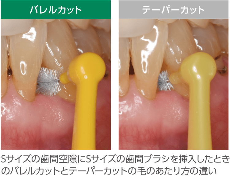 Sサイズの歯間空隙にSサイズの歯間ブラシを挿入したときのバレルカットとテーパーカットの毛のあたり方の違い