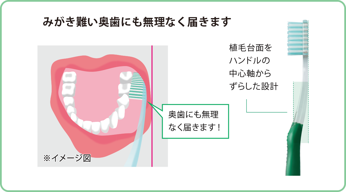 臼歯部にも届きやすいロングネックハンドル